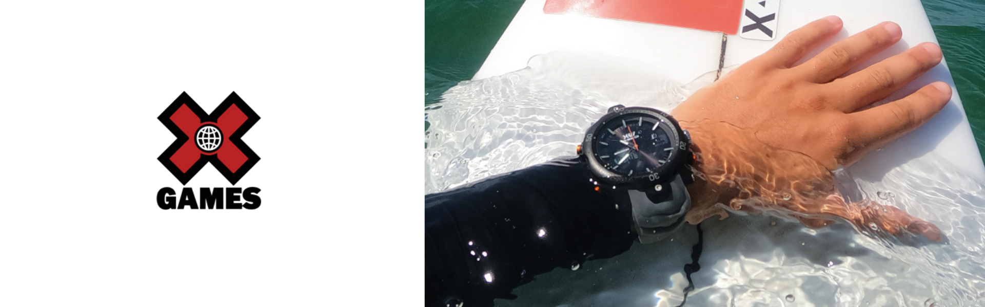 X-Watch